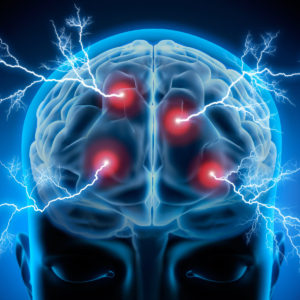 electrical nerve stimulation
